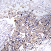 19 - Anti-JAK2 (Phospho-Y221) Antibody AP61174