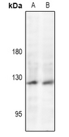 1 - Anti-JAK2 (Phospho-Y221) Antibody AP61174