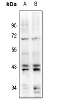 1 - Anti-ERK1/2 (Phospho-Y204) Antibody AP61175