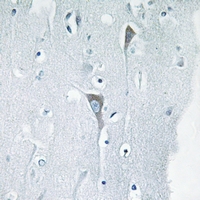 19 - Anti-JNK1/2/3 (Phospho-Y185) Antibody AP61176