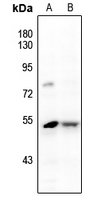 1 - Anti-JNK1/2/3 (Phospho-Y185) Antibody AP61176