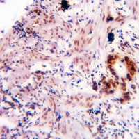 19 - Anti-Alpha-synuclein (Phospho-Y136) Antibody AP61177