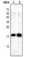 1 - Anti-Alpha-synuclein (Phospho-Y136) Antibody AP61177