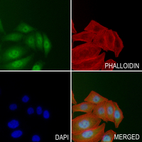 3 - Anti-EGFR (Phospho-Y1110) Antibody AP61178