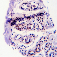 19 - Anti-EGFR (Phospho-Y1110) Antibody AP61178