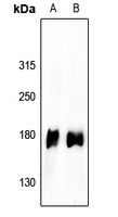 1 - Anti-EGFR (Phospho-Y1110) Antibody AP61178