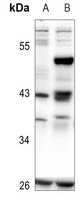 1 - Anti-CREB (Phospho-S111) Antibody AP61179
