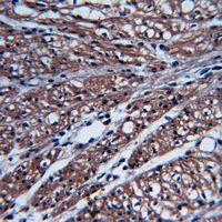 19 - Anti-Focal Adhesion Kinase (Phospho-S843) Antibody AP61180