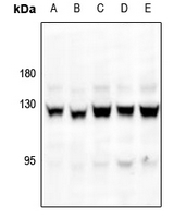 1 - Anti-Focal Adhesion Kinase (Phospho-S843) Antibody AP61180