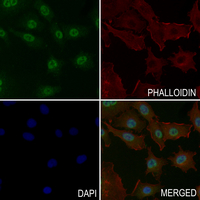 3 - Anti-FOXO3 (Phospho-S315) Antibody AP61181