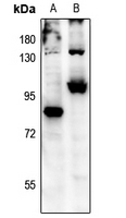 1 - Anti-FOXO3 (Phospho-S315) Antibody AP61181