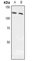 1 - Anti-USP28 (Phospho-S714) Antibody AP61182