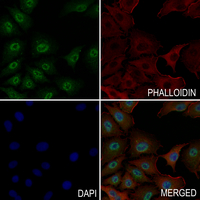 3 - Anti-ETS1 (Phospho-S282) Antibody AP61183