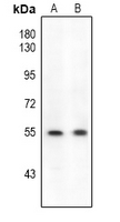 1 - Anti-ETS1 (Phospho-S282) Antibody AP61183