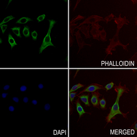 3 - Anti-TIE2 Antibody AP61184