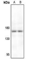 1 - Anti-TIE2 Antibody AP61184