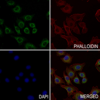 3 - Anti-TSC2 Antibody AP61185