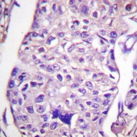 19 - Anti-TSC2 Antibody AP61185
