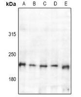 1 - Anti-TSC2 Antibody AP61185