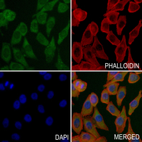 3 - Anti-Catalase Antibody AP61186
