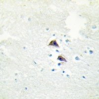 19 - Anti-Catalase Antibody AP61186