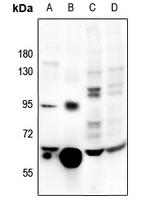 1 - Anti-Catalase Antibody AP61186