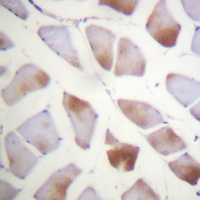 19 - Anti-Alpha-crystallin B Antibody AP61187