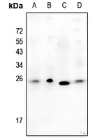1 - Anti-Alpha-crystallin B Antibody AP61187