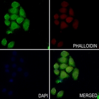 3 - Anti-PYK2 Antibody AP61188