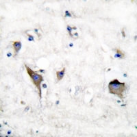 19 - Anti-PYK2 Antibody AP61188