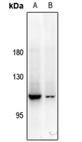 1 - Anti-PYK2 Antibody AP61188
