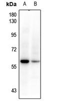 1 - Anti-BRK Antibody AP61190