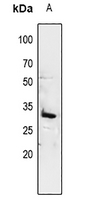 1 - Anti-14-3-3 sigma Antibody AP61193