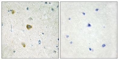 19 - Anti-NDUFC2 Antibody AP61194