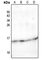 1 - Anti-NDUFC2 Antibody AP61194