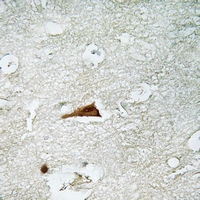 19 - Anti-p19 INK4d Antibody AP61196
