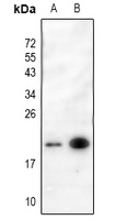 1 - Anti-p19 INK4d Antibody AP61196