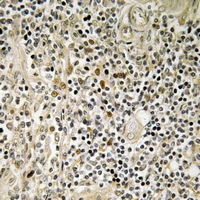 19 - Anti-ZNF225 Antibody AP61197