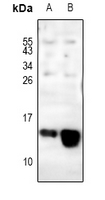 1 - Anti-COX6C Antibody AP61198