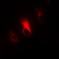 3 - Anti-Collagen 4 alpha 3 Antibody AP61199