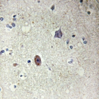 19 - Anti-Collagen 4 alpha 3 Antibody AP61199