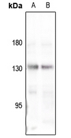 1 - Anti-Collagen 4 alpha 3 Antibody AP61199
