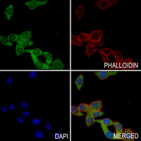 3 - Anti-IFIT1 Antibody AP61202