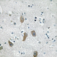 19 - Anti-IFIT1 Antibody AP61202