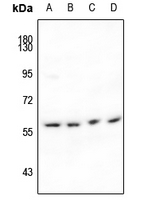 1 - Anti-IFIT1 Antibody AP61202