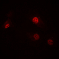 3 - Anti-RAD23A Antibody AP61204