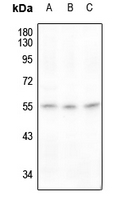 1 - Anti-RAD23A Antibody AP61204