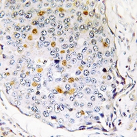 19 - Anti-RPS27L Antibody AP61205