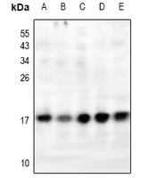 1 - Anti-RPL31 Antibody AP61206