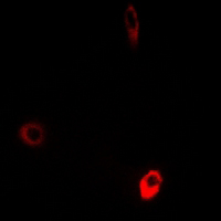 3 - Anti-ATP5D Antibody AP61207